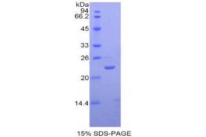 SDS-PAGE (SDS) image for Sialic Acid Binding Ig-Like Lectin 12 (SIGLEC12) (AA 317-512) protein (His tag) (ABIN1877928)