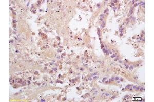 anti-PACAP-27/38 (AA 132-169) antibody
