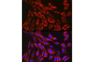 Immunofluorescence analysis of NIH/3T3 cells using Collagen III alpha 1/COL3 antibody (ABIN7266459) at dilution of 1:100. (COL3 anticorps)