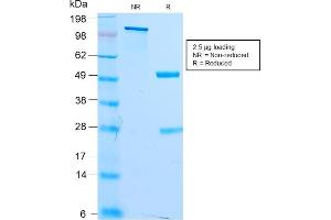 SDS-PAGE Analysis Purified MITF Recombinant Rabbit Monoclonal Antibody (MITF/2987R). (Recombinant MITF anticorps)