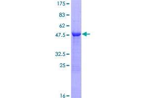 Image no. 1 for RAB28, Member RAS Oncogene Family (RAB28) (AA 1-221) protein (GST tag) (ABIN1317090)