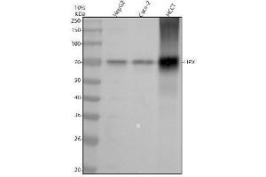 Western blot analysis of Hemopexin/HPX using anti-Hemopexin/HPX antibody (ABIN7605083).