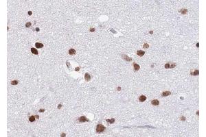ABIN6268809 at 1/100 staining human brain tissue sections by IHC-P. (HNRNPC anticorps  (C-Term))