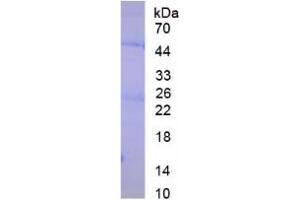 Image no. 1 for IgG protein (ABIN1877189) (IgG Protéine)
