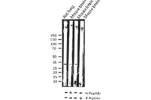 Western blot analysis of Phospho-C/EBP beta (Thr235/188) expression in various lysates (CEBPB anticorps  (pThr235))