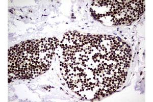 anti-Nibrin (NBN) (AA 183-460) antibody