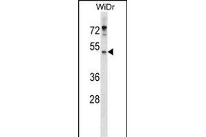 EN Antibody (Center) (ABIN1537947 and ABIN2849680) western blot analysis in WiDr cell line lysates (35 μg/lane). (ENPP4 anticorps  (AA 171-200))
