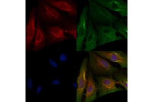 ABIN6263511 and ABIN6276331 staining  cells by IF/ICC.