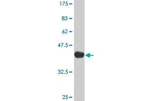 Western Blot detection against Immunogen (36. (IRAK2 anticorps  (AA 111-210))