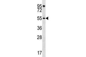 AKT1 antibody western blot analysis in HeLa lysate
