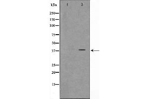 Western blot analysis on K562 cell lysate using ARMX3 Antibody,The lane on the left is treated with the antigen-specific peptide. (ARMCX3 anticorps  (N-Term))