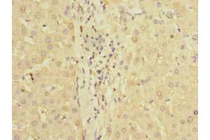 Immunohistochemistry of paraffin-embedded human liver tissue using ABIN7163092 at dilution of 1:100 (PDCL2 anticorps  (AA 1-241))