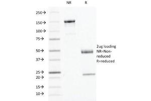 SDS-PAGE Analysis of Purified, BSA-Free IFN gamma Antibody (clone IFNG/466). (Interferon gamma anticorps)