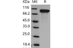 Western Blotting (WB) image for Discoidin Domain Receptor tyrosine Kinase 2 (DDR2) (Active) protein (His tag) (ABIN7320240)