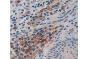 IHC-P analysis of Human Tissue, with DAB staining. (FBLN4 anticorps  (AA 278-366))