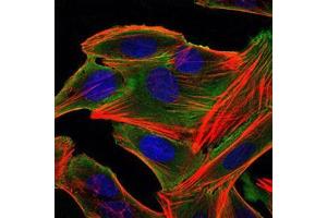 Immunofluorescence analysis of HepG2 cells using RSK2 mouse mAb (green).