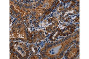 Immunohistochemistry (IHC) image for anti-P53-Induced Death Domain Protein (PIDD) antibody (ABIN2423738) (PIDD anticorps)