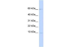Image no. 1 for anti-Peptidase Inhibitor 3, Skin-Derived (PI3) antibody (ABIN635954) (PI3 anticorps)