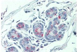Immunohistochemistry (Formalin/PFA-fixed paraffin-embedded sections) of human breast tissue with ITGA6 polyclonal antibody . (ITGA6 anticorps  (Internal Region))