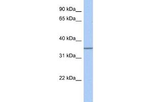 WB Suggested Anti-GLT6D1 Antibody Titration:  0.