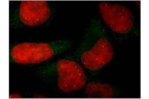 Image no. 1 for anti-Survival of Motor Neuron 1, Telomeric (SMN1) antibody (ABIN2628560) (SMN1 anticorps)