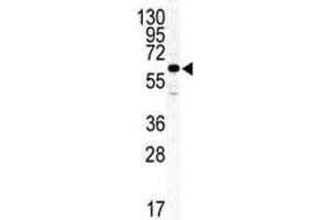 Western blot analysis of ILK2/ILK1 antibody and HeLa lysate.