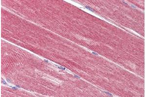 Skeletal muscle, Human: Formalin-Fixed, Paraffin-Embedded (FFPE) (IDE anticorps  (AA 222-233))