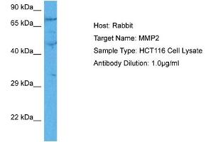 Host:  Rabbit  Target Name:  MMP2  Sample Tissue:  Human HCT116 Whole Cell  Antibody Dilution:  1ug/ml (MMP2 anticorps  (C-Term))