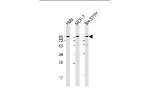 All lanes : Anti-DAG1 Antibody (C-term) at 1:2000 dilution Lane 1: Hela whole cell lysate Lane 2: MCF-7 whole cell lysate Lane 3: SH-SY5Y whole cell lysate Lysates/proteins at 20 μg per lane. (Dystroglycan anticorps  (C-Term))