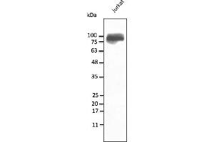 Western Blotting (WB) image for anti-Integrin beta 2 (ITGB2) (N-Term) antibody (ABIN7273029) (Integrin beta 2 anticorps  (N-Term))