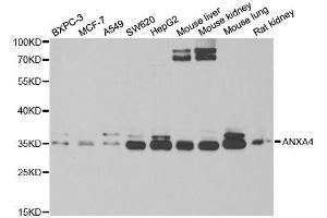 Western blot analysis of extracts of various cell lines, using ANXA4 antibody. (Annexin IV anticorps  (AA 112-321))