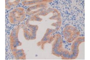 IHC-P analysis of Mouse Ovary Tissue, with DAB staining. (PDGFRB anticorps  (AA 337-583))