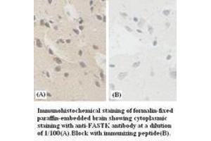 Image no. 1 for anti-Fas-Activated serine/threonine Kinase (FASTK) antibody (ABIN791134) (FASTK anticorps)