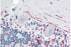 Human Brain, Cerebellum (formalin-fixed, paraffin-embedded) stained with MBP antibody ABIN364503 at 1:100 followed by biotinylated goat anti-rabbit IgG secondary antibody ABIN481713, alkaline phosphatase-streptavidin and chromogen. (MBP anticorps)
