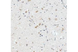 IHC analysis of RPL29 using anti-RPL29 antibody (ABIN7600993). (RPL29 anticorps  (AA 27-153))