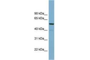 Image no. 1 for anti-CDK5 Regulatory Subunit Associated Protein 1 (CDK5RAP1) (AA 92-141) antibody (ABIN6742000) (CDK5RAP1 anticorps  (AA 92-141))