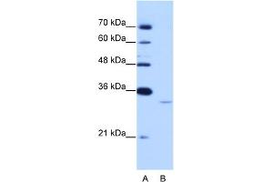 WB Suggested Anti-EXOSC6 Antibody Titration:  0. (EXOSC6 anticorps  (N-Term))