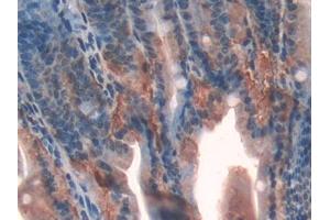 Used in DAB staining on fromalin fixed paraffin- embedded spleen tissue (Galectin 9 anticorps  (AA 194-322))