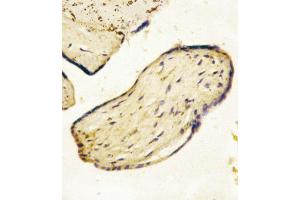 Formalin-fixed and paraffin-embedded human Placenta tissue reacted with CD73 (NT5E) Antibody (C-term), which was peroxidase-conjugated to the secondary antibody, followed by AEC staining. (CD73 anticorps  (C-Term))