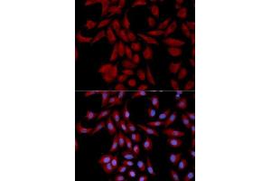 Immunofluorescence analysis of U2OS cells using UBE2I antibody. (UBE2I anticorps  (AA 1-158))
