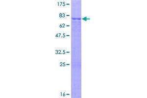 Image no. 1 for Suppressor of Variegation 3-9 Homolog 1 (Drosophila) (SUV39H1) (AA 1-412) protein (GST tag) (ABIN1321936)