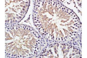 Paraformaldehyde-fixed, paraffin embedded rat testis, Antigen retrieval by boiling in sodium citrate buffer (pH6) for 15min, Block endogenous peroxidase by 3% hydrogen peroxide for 30 minutes, Blocking buffer (normal goat serum) at 37°C for 20min, Antibody incubation with 	GRINA Polyclonal Antibody, Unconjugated  at 1:200 overnight at 4°C, followed by a conjugated secondary and DAB staining
