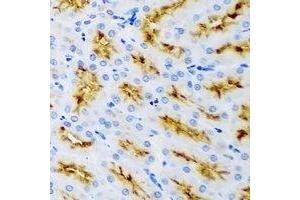 Immunohistochemistry (IHC) image for anti-Receptor-Interacting Serine-threonine Kinase 2 (RIPK2) antibody (ABIN7308278)