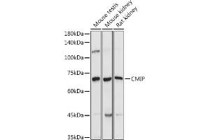 Western blot analysis of extracts of various cell lines, using CMIP antibody (ABIN7265970) at 1:1000 dilution. (CMIP anticorps)