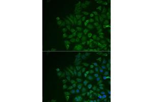 anti-Lecithin Retinol Acyltransferase (Phosphatidylcholine--Retinol O-Acyltransferase) (LRAT) (AA 1-194) antibody