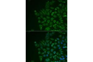 Immunofluorescence analysis of MCF7 cells using LRAT antibody (ABIN6132018, ABIN6143312, ABIN6143315 and ABIN6217189). (LRAT anticorps  (AA 1-194))