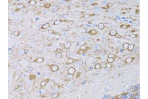 Immunohistochemistry of paraffin-embedded mouse brain using MYH10 antibody.