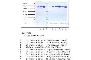 Gel Scan of C1 Esterase Inhibitor, Human Plasma  This information is representative of the product ART prepares, but is not lot specific.