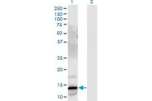 Western Blot analysis of GRP expression in transfected 293T cell line by GRP monoclonal antibody (M03), clone 3A11. (Gastrin-Releasing Peptide anticorps  (AA 1-148))