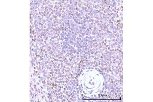 IHC analysis of Nesprin3/SYNE3 using anti-Nesprin3/SYNE3 antibody (ABIN7601328). (Nesprin3 anticorps  (AA 322-495))